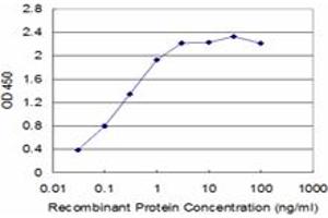 Detection limit for recombinant GST tagged SLC11A1 is approximately 0. (SLC11A1 Antikörper  (AA 308-350))