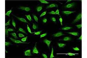 Immunofluorescence of monoclonal antibody to SMAD7 on HeLa cell. (SMAD7 Antikörper  (AA 160-260))