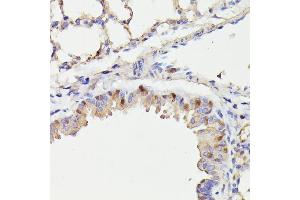 Immunohistochemistry of paraffin-embedded mouse lung using CDC23 antibody (ABIN7266248) at dilution of 1:100 (40x lens). (CDC23 Antikörper  (AA 50-150))