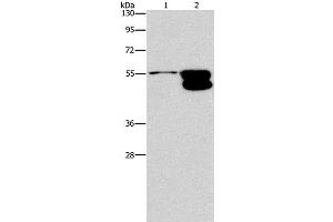 Western Blot analysis of NIH/3T3 cell and Mouse brain tissue using CRHR2 Polyclonal Antibody at dilution of 1:650 (CRHR2 Antikörper)