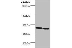 Western blot All lanes: PNP antibody at 10 μg/mL Lane 1: Jurkat whole cell lysate Lane 2: K562 whole cell lysate Secondary Goat polyclonal to rabbit IgG at 1/10000 dilution Predicted band size: 32 kDa Observed band size: 32 kDa (PNP Antikörper  (AA 1-289))