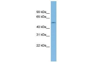 ETF1 antibody used at 1 ug/ml to detect target protein. (ETF1 Antikörper  (N-Term))