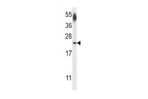 Western blot analysis of lysate from human brain tissue lysate, using CNRP1 Antibody (Center) (ABIN656608 and ABIN2845865). (Cnrip1 Antikörper  (AA 76-104))