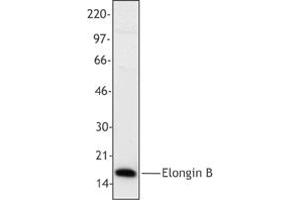 Image no. 1 for anti-Transcription Elongation Factor B (SIII), Polypeptide 2 (18kDa, Elongin B) (TCEB2) antibody (ABIN205406) (TCEB2 Antikörper)