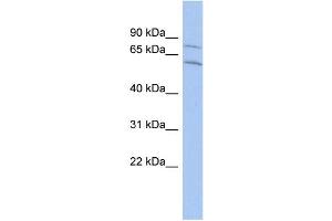 WB Suggested Anti-CNOT2 Antibody Titration:  0. (CNOT2 Antikörper  (Middle Region))