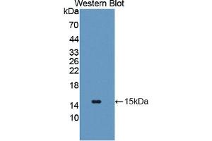 Western blot analysis of the recombinant protein. (SLC2A14 Antikörper  (AA 1-105))