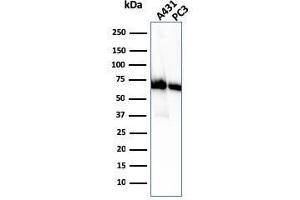 Western Blot Analysis of A431 and PC-3 cell lysate using CD73 Mouse Monoclonal Antibody (NT5E/2505). (CD73 Antikörper)