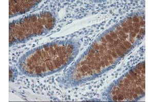 anti-Adaptor-Related Protein Complex 2, mu 1 Subunit (AP2M1) (AA 97-383) antibody