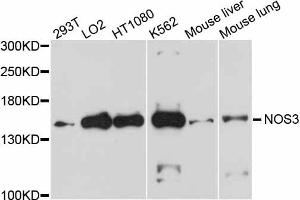 Western blot analysis of extracts of various cell lines, using NOS3 antibody (ABIN1873922) at 1:1000 dilution. (ENOS Antikörper)