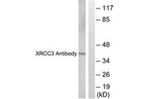 Western Blotting (WB) image for anti-X-Ray Repair Complementing Defective Repair in Chinese Hamster Cells 3 (XRCC3) (AA 41-90) antibody (ABIN2889294)