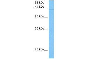 Western Blotting (WB) image for anti-Solute Carrier Family 12 (Potassium-Chloride Transporter) Member 2 (SLC12A2) (N-Term) antibody (ABIN5516409)