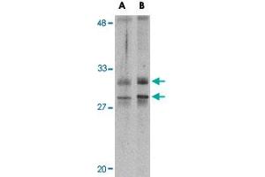 Western blot analysis of METTL7A in MCF-7 cell lysate with METTL7A polyclonal antibody  at 2 ug/mL . (METTL7A Antikörper  (Internal Region))