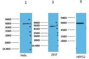 Western Blot (WB) analysis of 1) HeLa, 2) 293T, 3) HepG, diluted at 1:2000. (NF-kB p65 Antikörper)