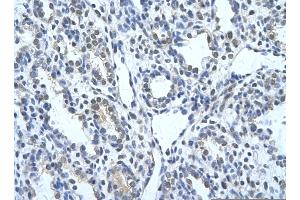 Rabbit Anti-KRT17 Antibody       Paraffin Embedded Tissue:  Human alveolar cell   Cellular Data:  Epithelial cells of renal tubule  Antibody Concentration:   4.