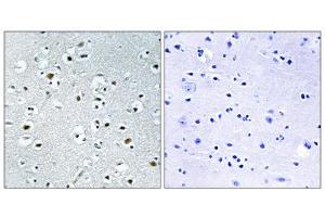 Immunohistochemistry analysis of paraffin-embedded human brain tissue using PPRC1 antibody. (PPRC1 Antikörper  (C-Term))