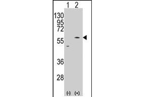 Western blot analysis of PMAT (SLC29A4) (arrow) using rabbit SLC29A4 polyclonal antibody . (SLC29A4 Antikörper  (AA 459-489))