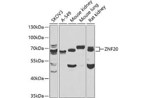 Western blot analysis of extracts of various cell lines, using ZNF20 antibody  at 1:1000 dilution. (ZNF20 Antikörper  (AA 1-200))
