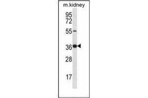 Western blot analysis of GRXCR1 Antibody (Center) in mouse kidney tissue lysates (35ug/lane).