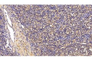 Detection of TGFb1 in Porcine Lymph node Tissue using Polyclonal Antibody to Transforming Growth Factor Beta 1 (TGFb1) (TGFB1 Antikörper  (AA 279-390))