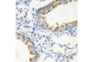 Immunohistochemistry of paraffin-embedded mouse lung using IRAK2 antibody. (IRAK2 Antikörper)