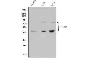 Western blot analysis of p75 NGF Receptor/NGFR using anti-p75 NGF Receptor/NGFR antibody (ABIN7601116).