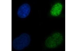 IF analysis of CBR1 using anti-CBR1 antibody (ABIN7600015). (CBR1 Antikörper  (AA 14-262))