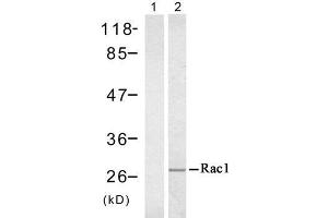 Western blot analysis of extract from A431 cell untreated or treated with EGF (200ng/ml, 5min), using Rac1 (Ab-71) antibody (E021201). (RAC1 Antikörper)