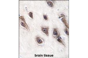 Formalin-fixed and paraffin-embedded human brain tissue reacted with GRB2 antibody (Center), which was peroxidase-conjugated to the secondary antibody, followed by DAB staining. (GRB2 Antikörper  (AA 89-118))