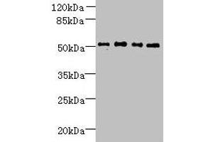 Western blot All lanes: TTC38 antibody at 1. (TTC38 Antikörper  (AA 2-200))