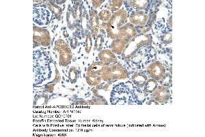 Rabbit Anti-APOBEC3D Antibody  Paraffin Embedded Tissue: Human Kidney Cellular Data: Epithelial cells of renal tubule Antibody Concentration: 4.