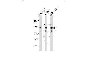 All lanes : Anti-SED Antibody (N-term) at 1:2000 dilution Lane 1: HACAT whole cell lysate Lane 2: Hela whole cell lysate Lane 3: SH-SY5Y whole cell lysate Lysates/proteins at 20 μg per lane. (SEMA6D Antikörper  (N-Term))