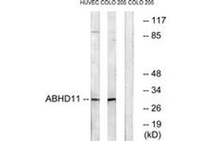 Western blot analysis of extracts from COLO/HuvEc cells, using ABHD11 Antibody. (ABHD11 Antikörper  (AA 161-210))