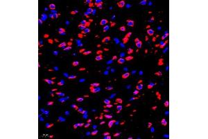 Immunofluorescence of paraffin embedded rat brain using P4H (ABIN7074215) at dilution of 1:700 (400x lens) (HIF Prolyl Hydroxylase Antikörper)