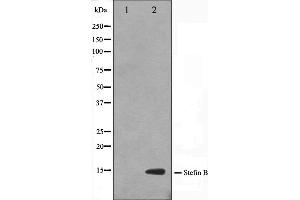 Western blot analysis on A549 cell lysate using CSTB Antibody,The lane on the left is treated with the antigen-specific peptide.