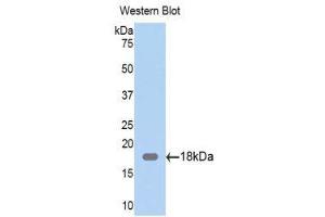 Western Blotting (WB) image for anti-Zyxin (ZYX) (AA 377-523) antibody (ABIN1860974) (ZYX Antikörper  (AA 377-523))