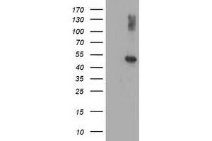 Western Blotting (WB) image for anti-Adaptor-Related Protein Complex 2, mu 1 Subunit (AP2M1) (AA 97-383) antibody (ABIN1491720) (AP2M1 Antikörper  (AA 97-383))