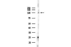 anti-Lon Peptidase 1, Mitochondrial (LONP1) (C-Term) antibody