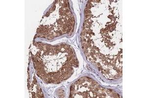 Immunohistochemical staining of human testis with FABP12 polyclonal antibody  shows strong cytoplasmic positivity in cells of seminiferus ducts at 1:10-1:20 dilution. (FABP12 Antikörper)