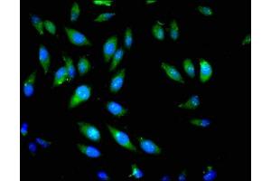 Immunofluorescent analysis of Hela cells using ABIN7163192 at dilution of 1:100 and Alexa Fluor 488-congugated AffiniPure Goat Anti-Rabbit IgG(H+L) (PIK3CB Antikörper  (Catalytic Subunit beta))