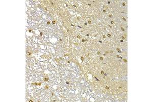 Immunohistochemistry of paraffin-embedded rat brain using S100A4 antibody (ABIN5970801) at dilution of 1/100 (40x lens). (s100a4 Antikörper)
