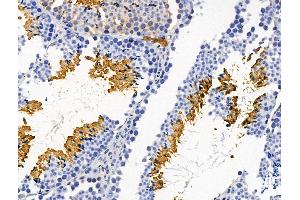 ABIN7094644 and ABIN7098694 at 1/100 staining Mouse testis tissue by IHC-P. (Plastin 3 Antikörper  (Internal Region))