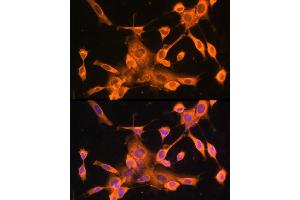 Immunofluorescence analysis of NIH-3T3 cells using FOXO3A Rabbit pAb (ABIN6129381, ABIN6140755, ABIN6140756 and ABIN6213618) at dilution of 100 (40x lens). (FOXO3 Antikörper  (AA 394-672))