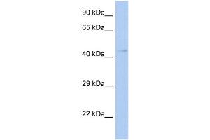 WB Suggested Anti-TFDP3 Antibody Titration:  0. (TFDP3 Antikörper  (Middle Region))