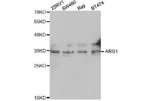 Western Blotting (WB) image for anti-Arginase, Liver (ARG1) antibody (ABIN1875417) (Liver Arginase Antikörper)