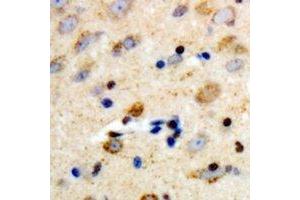 Immunohistochemical analysis of PLC beta 3 staining in human brain formalin fixed paraffin embedded tissue section. (PLCB3 Antikörper  (C-Term))