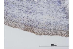 Immunoperoxidase of purified MaxPab antibody to SFRS5 on formalin-fixed paraffin-embedded human ovary.