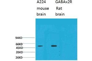 Western Blot (WB) analysis of 1) Mouse Brain Tissue, 2)Rat Brain Tissue with GABA A Receptor alpha2 Rabbit Polyclonal Antibody diluted at 1:2000. (GABRA2 Antikörper)