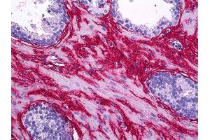 Immunohistochemistry (IHC) image for anti-Collagen, Type I, alpha 1 (COL1A1) antibody (ABIN2471488)