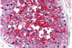 Human Testis (formalin-fixed, paraffin-embedded) stained with BSG antibody ABIN239809 at 10 ug/ml followed by biotinylated anti-mouse IgG secondary antibody ABIN481714, alkaline phosphatase-streptavidin and chromogen. (CD147 Antikörper)