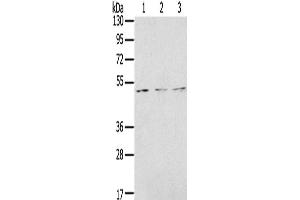 Western Blotting (WB) image for anti-Forkhead Box G1 (FOXG1) antibody (ABIN2431349) (FOXG1 Antikörper)